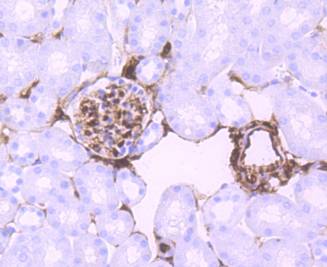 Anti-S100A6 Antibody (9N771)