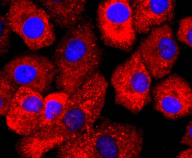 Anti-ATP2A2 Antibody (2R687)
