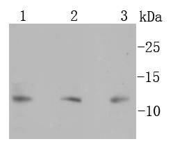 Anti-S100B Antibody (4A182)