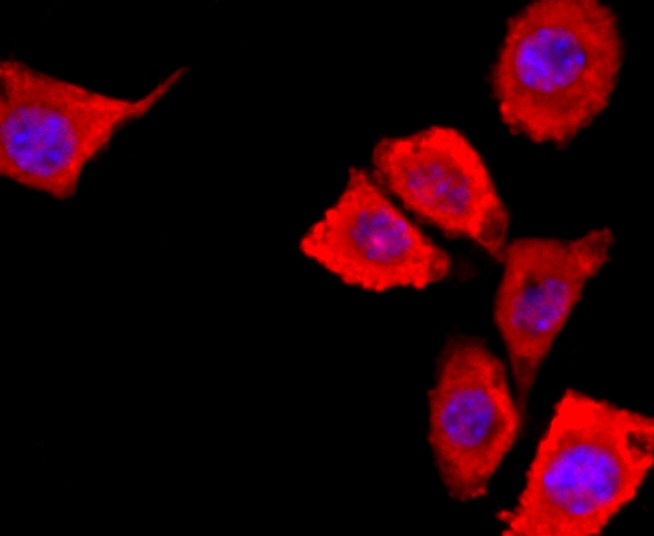 Anti-S100A6 Antibody (9N771)