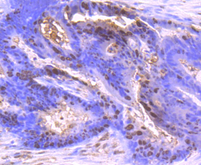 Anti-S100A6 Antibody (9N771)