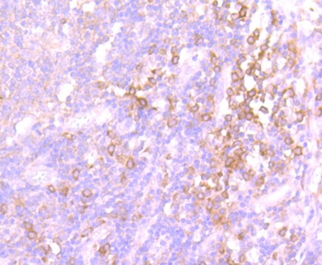Anti-Src Antibody (6Y413)