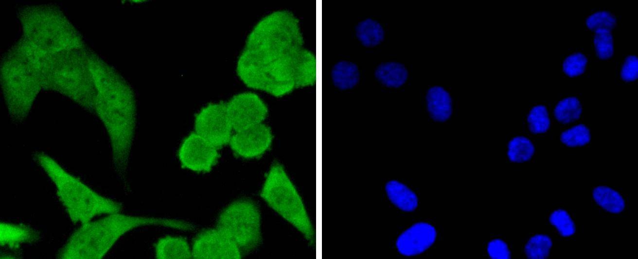 Anti-STAT1 Antibody (5F189)