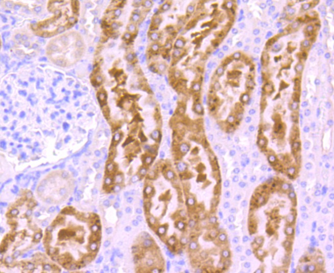 Anti-Src Antibody (6Y413)