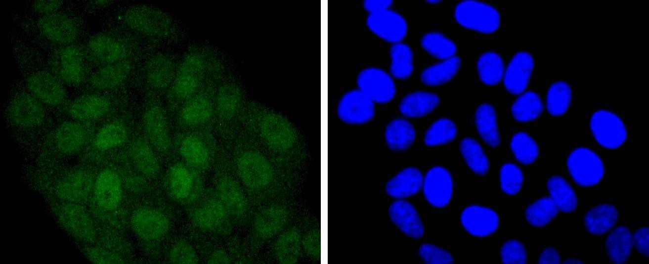 Anti-STAT5A/B Antibody (8D628)