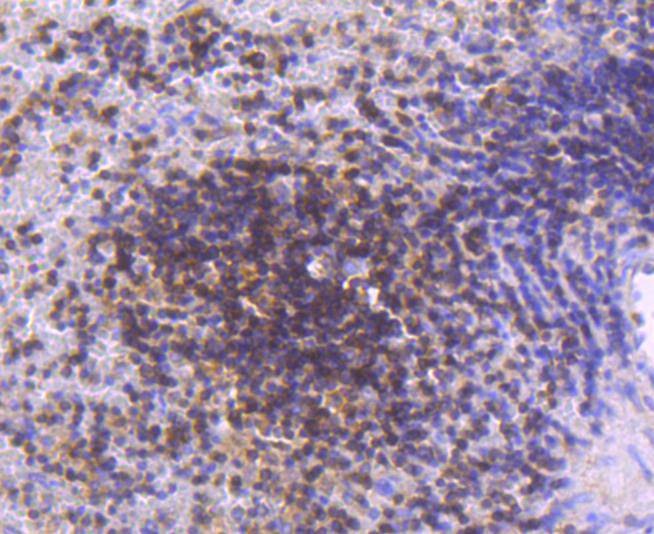 Anti-STAT5A/B Antibody (8D628)