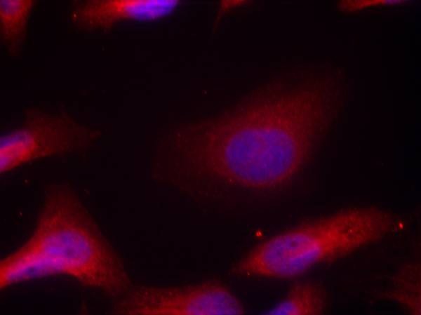 Anti-Phospho-Src (Tyr529) Polyclonal Antibody