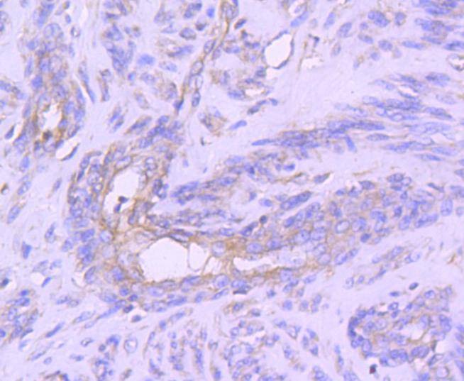 Anti-STAT1 Antibody (5F189)