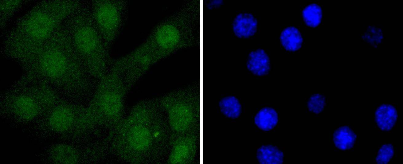 Anti-STAT5A/B Antibody (8D628)