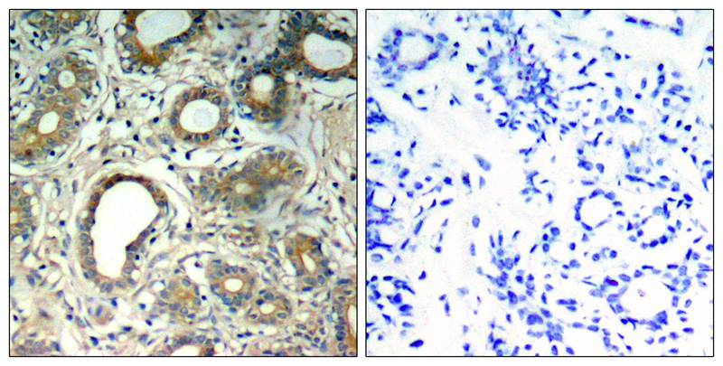 Anti-Phospho-PTPN11 (Tyr580) Polyclonal Antibody 2
