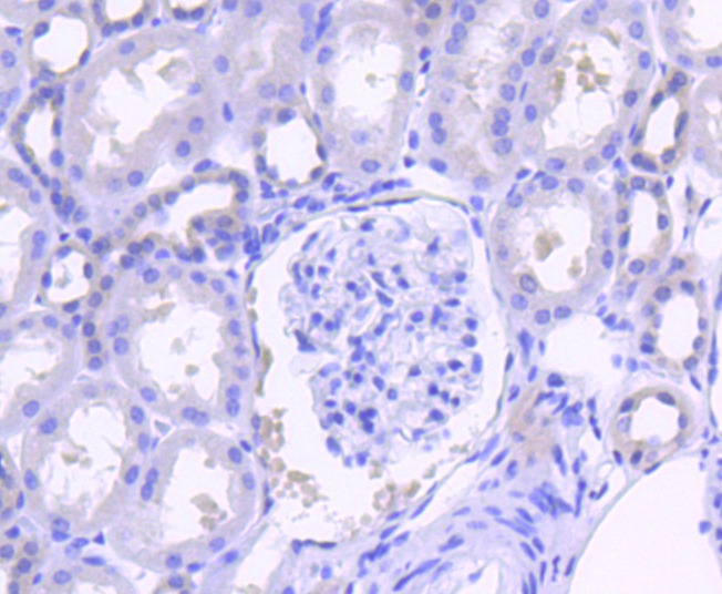 Anti-PTPN11 Antibody (1T267)