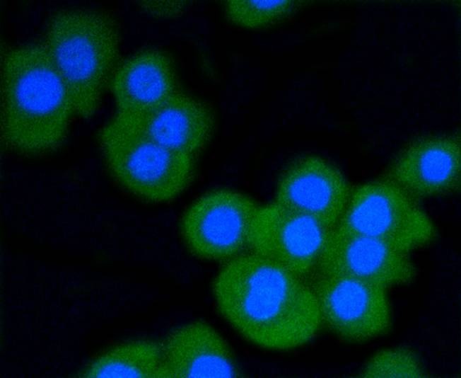 Anti-STAT3 Antibody (1Y299)