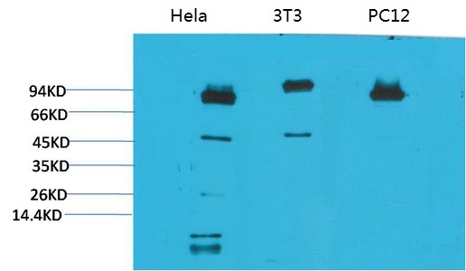 Anti-STAT3 Antibody (8P240)