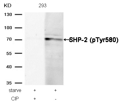 Anti-Phospho-PTPN11 (Tyr580) Polyclonal Antibody 2