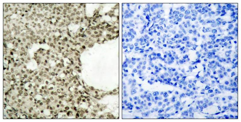 Anti-Phospho-STAT1 (Ser727) Polyclonal Antibody