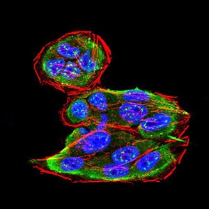 Anti-SK2 Antibody (4K957)