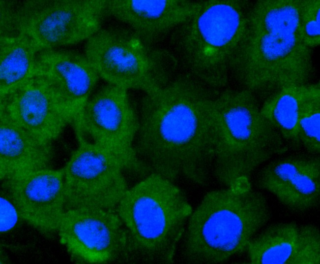 Anti-STAT2 Antibody (3V841)