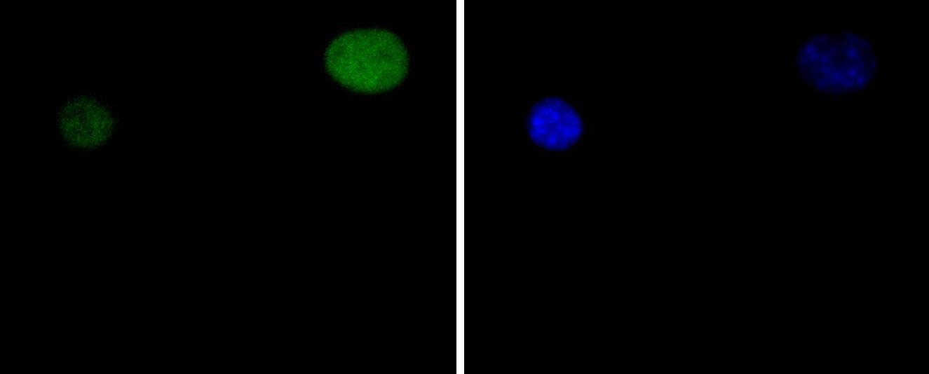 Anti-STAT5A Antibody (6E796)