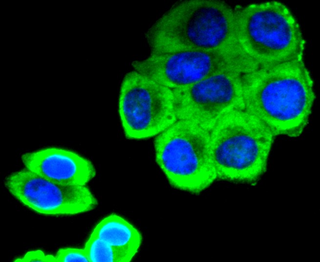 Anti-Phospho-SIRT1 (Ser47) Antibody (5Z724)