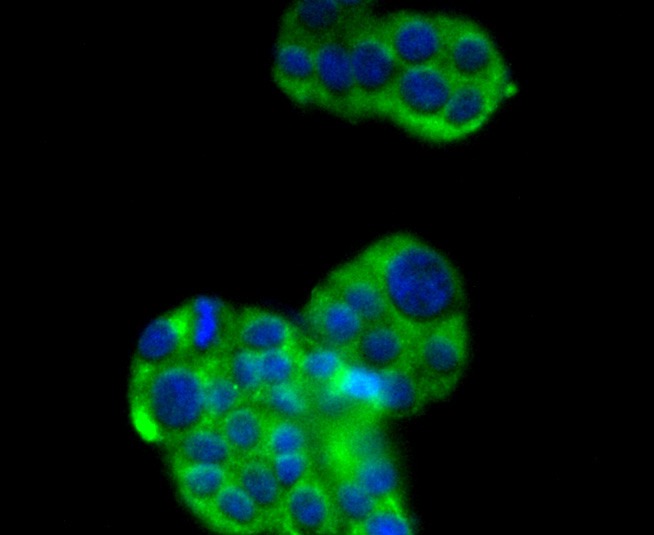 Anti-SIRT2 Antibody (2G702)