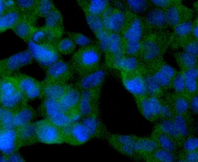 Anti-SIRT2 Antibody (2G702)