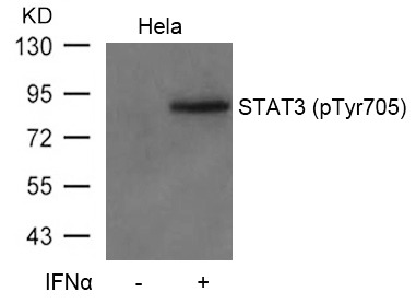 Anti-Phospho-STAT3 (Tyr705) Polyclonal Antibody 3