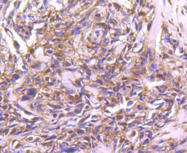Anti-STAT4 Antibody (9R238)