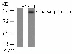 Anti-Phospho-STAT5A (Tyr694) Polyclonal Antibody