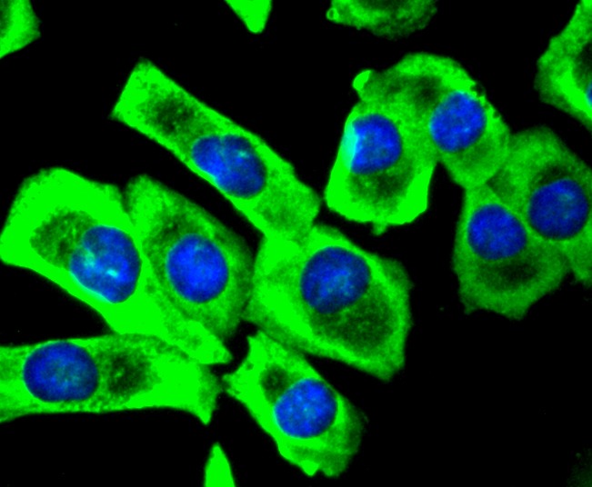 Anti-Phospho-SIRT1 (Ser47) Antibody (5Z724)