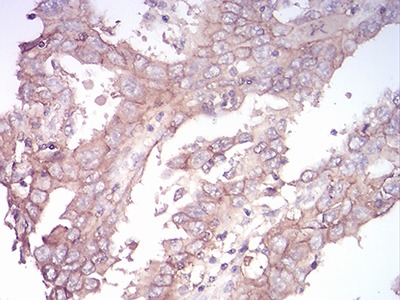 Anti-SK2 Antibody (4K957)