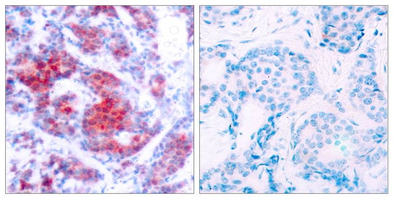 Anti-Phospho-STAT4 (Tyr693) Polyclonal Antibody 2