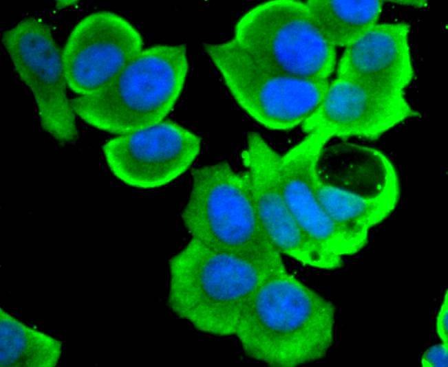 Anti-STAT4 Antibody (9R238)