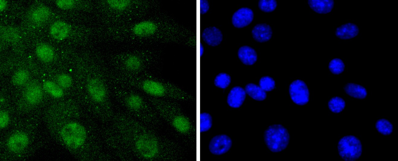 Anti-PTPN11 Antibody (1T267)