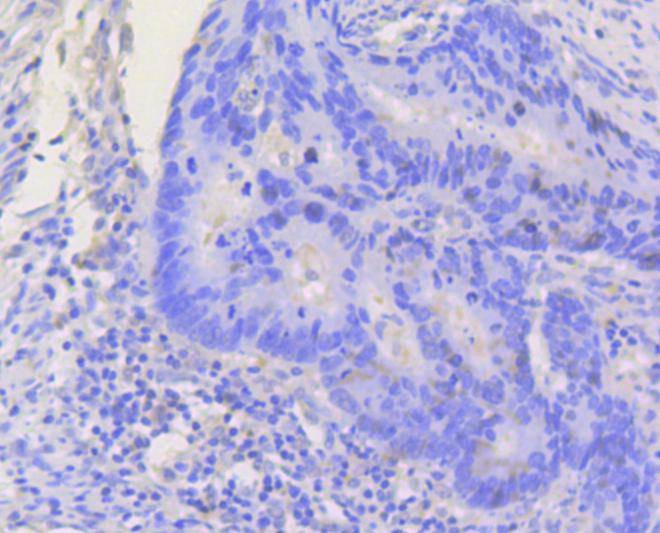 Anti-STAT3 Antibody (1Y299)