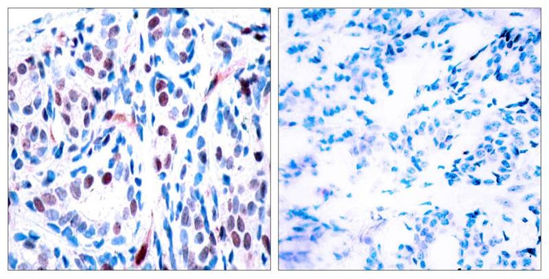 Anti-Phospho-STAT3 (Tyr705) Polyclonal Antibody 3