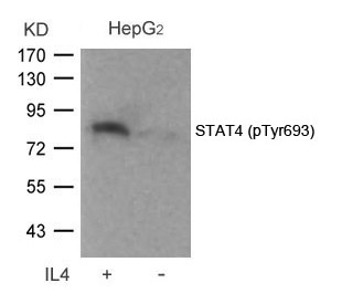 Anti-Phospho-STAT4 (Tyr693) Polyclonal Antibody 2