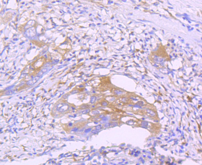 Anti-STAT2 Antibody (3V841)