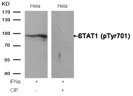 Anti-Phospho-STAT1 (Tyr701) Polyclonal Antibody 2