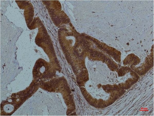 Anti-STAT3 Antibody (8P240)