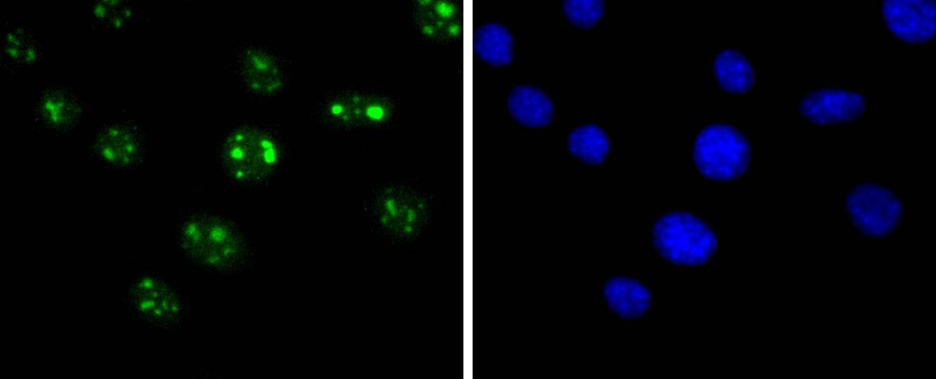 Anti-SIRT6 Antibody (6U297)