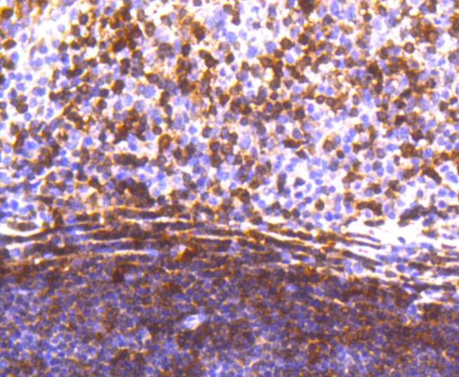 Anti-STAT5A Antibody (6E796)