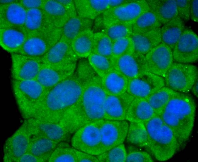 Anti-STAT4 Antibody (9R238)