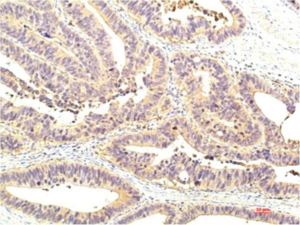 Anti-STAT1 Antibody (6Q259)