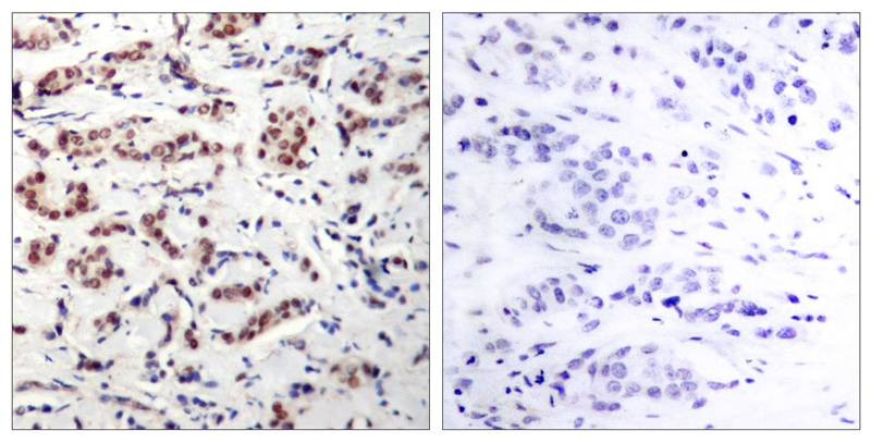 Anti-Phospho-STAT5A (Tyr694) Polyclonal Antibody
