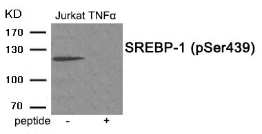 Anti-Phospho-SREBP-1 (Ser439) Polyclonal Antibody