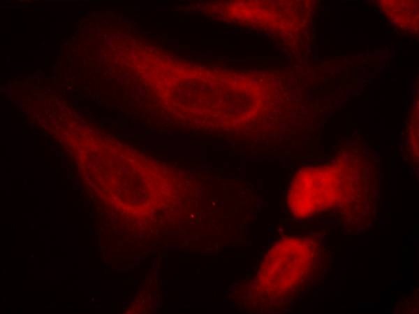 Anti-Phospho-STAT1 (Ser727) Polyclonal Antibody