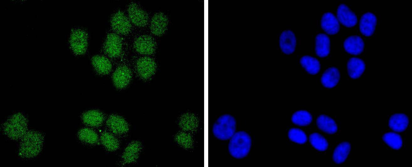 Anti-SUZ12 Antibody (5A460)