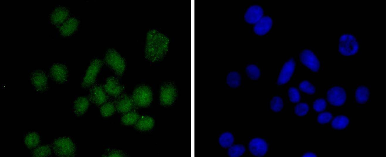 Anti-SUZ12 Antibody (5A460)
