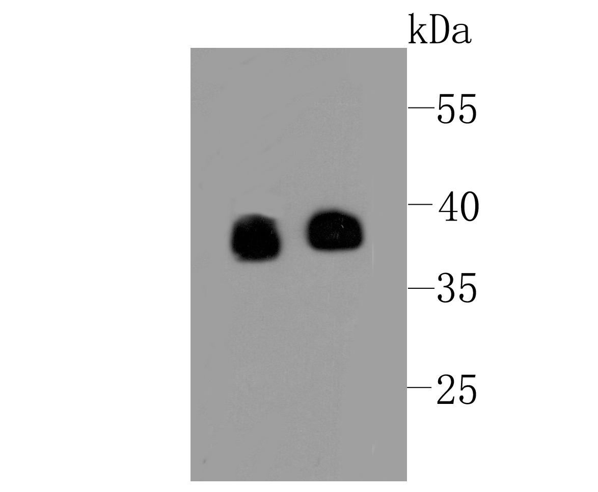 Anti-Synaptophysin/SYP Antibody (1U942)