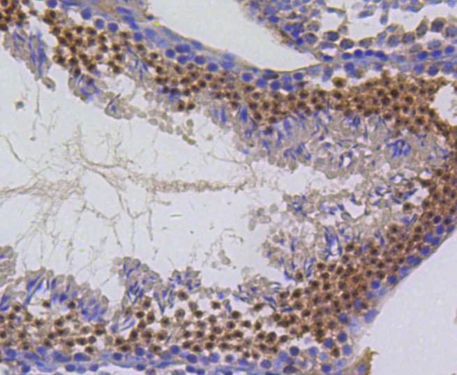 Anti-Survivin Antibody (2N702)